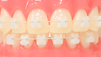 馴染むワイヤー