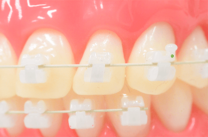 ローフリクションシステム